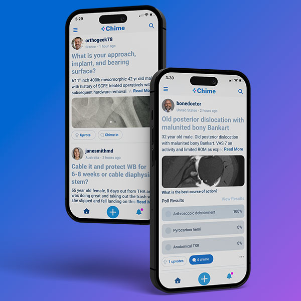 Exactech Chime Surgeon Mobile App