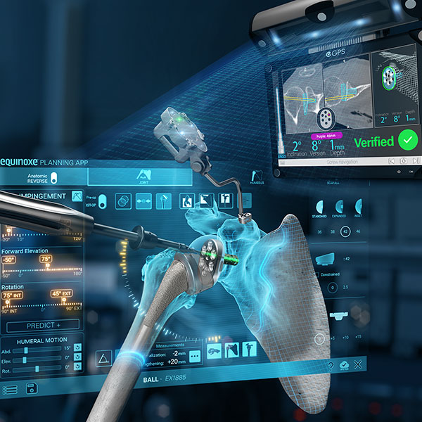 Exactech GPS Shoulder