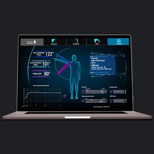 Exactech Predict+ Patient-Specific Outcome Predictor